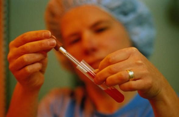 人流后孕囊多久排出来