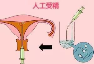 南通费用试管婴儿